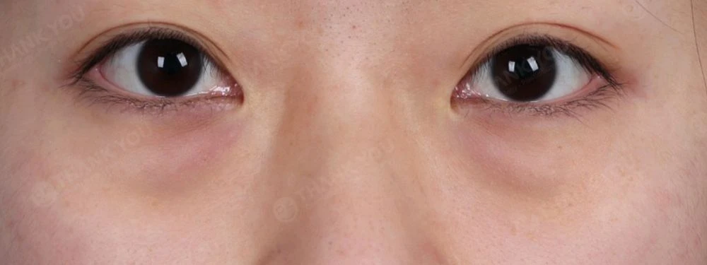 before_image