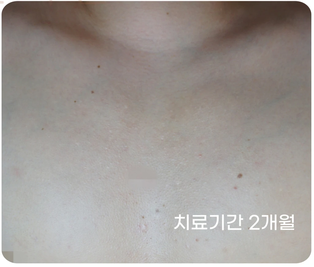 before_image