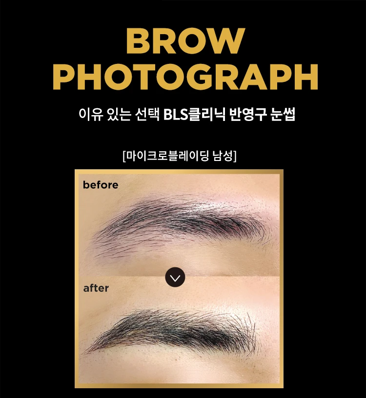 before_image