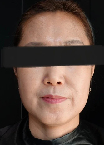 before_image