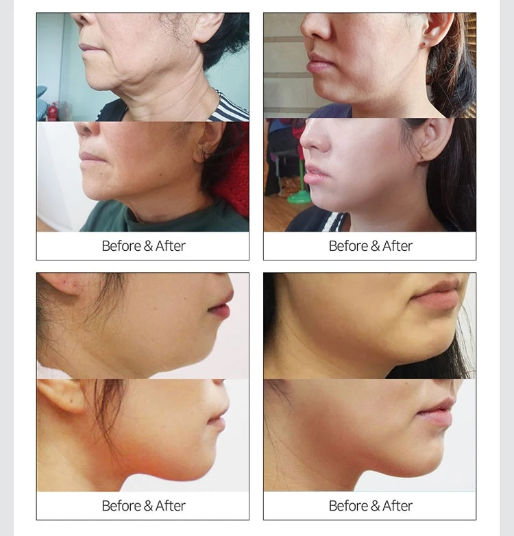 before_image