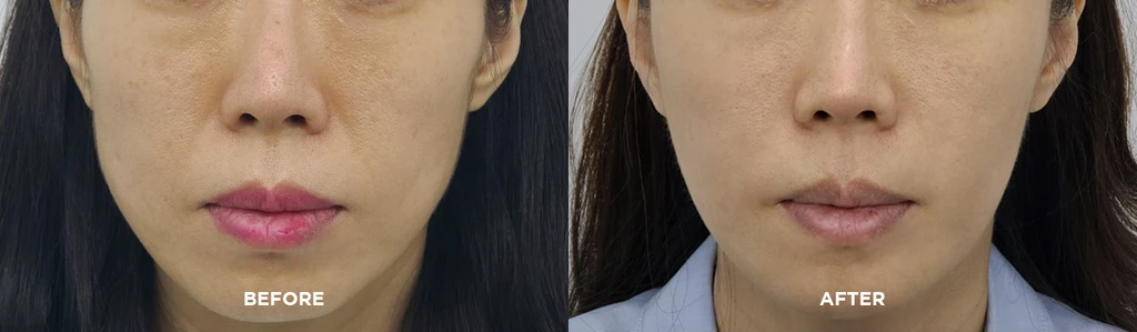 before_image