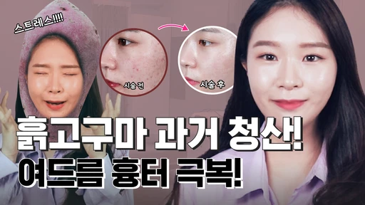 related_video_thumbnail