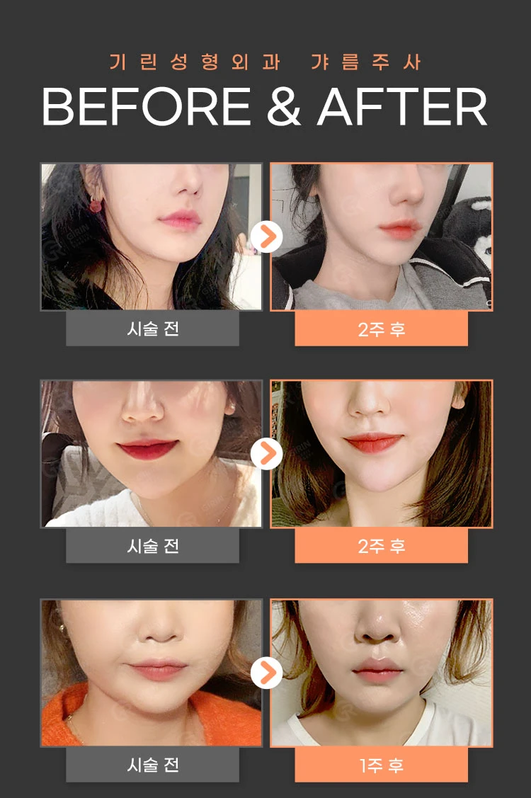before_image