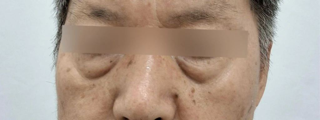 before_image