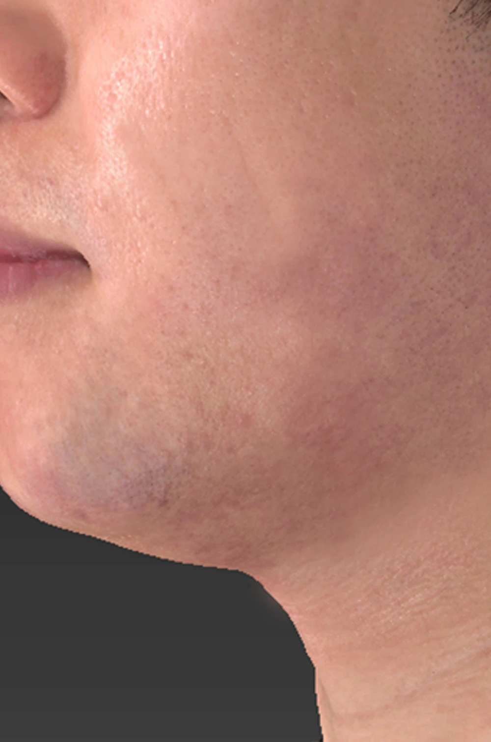 before_image