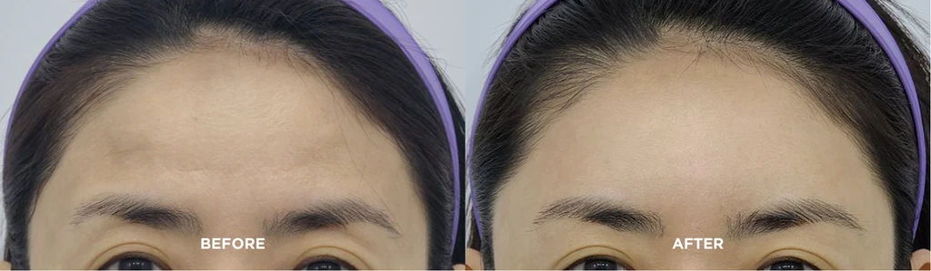 before_after