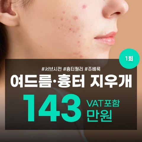 event thumbnail image