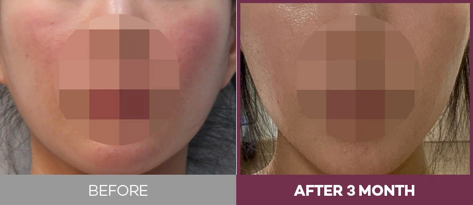 before_image