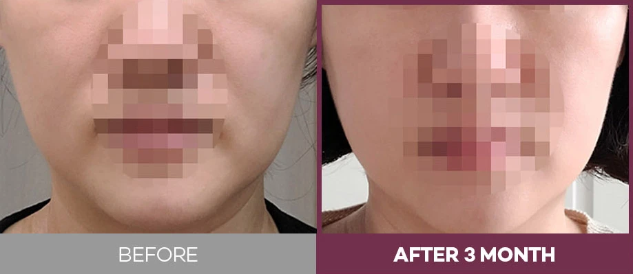 before_image