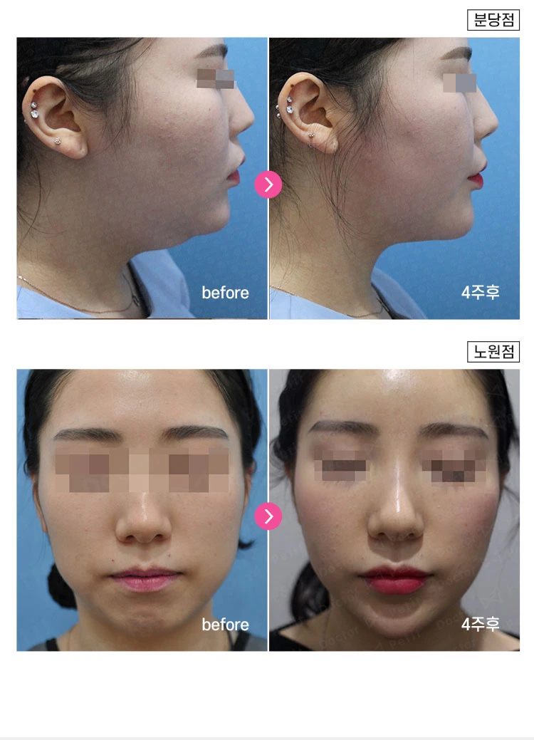 before_image