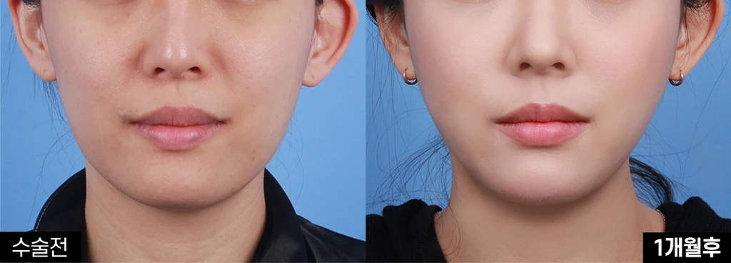 before_image