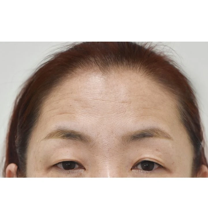 before_image