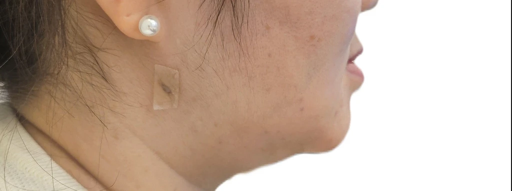 before_image