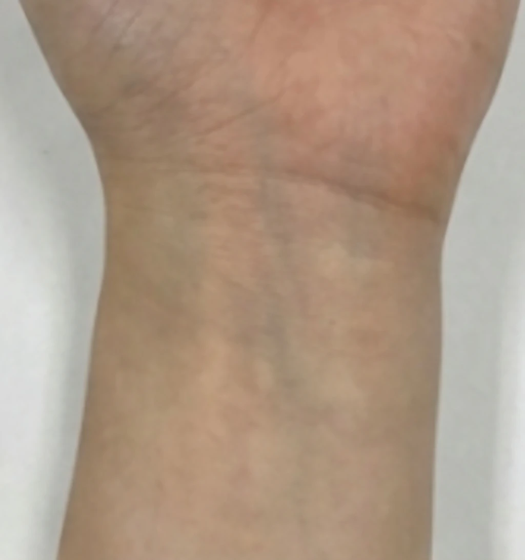 before_image