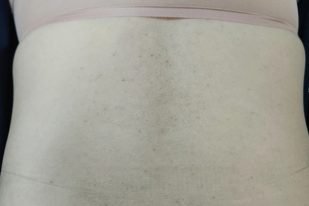 before_image