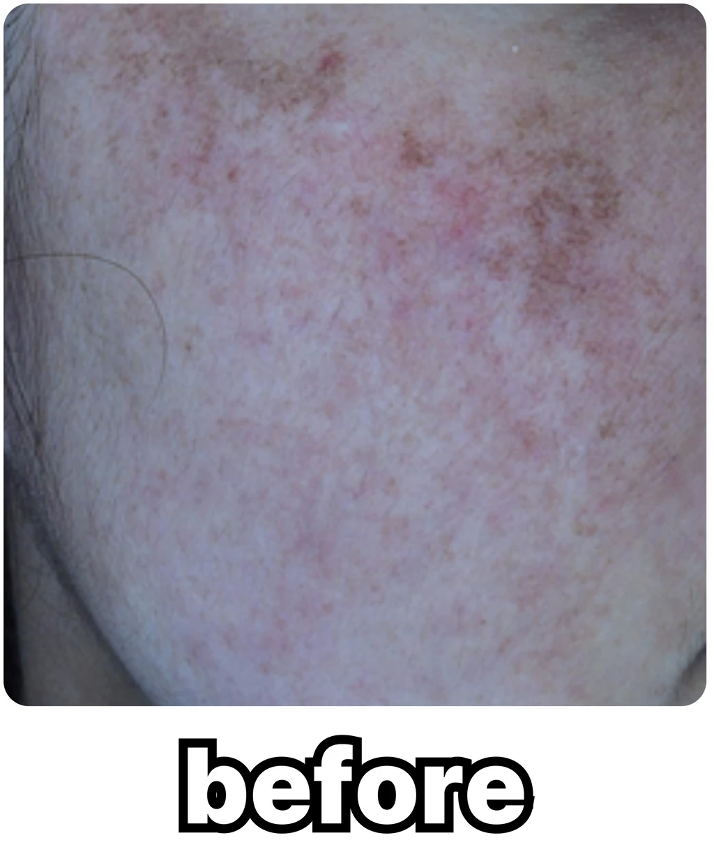 before_image