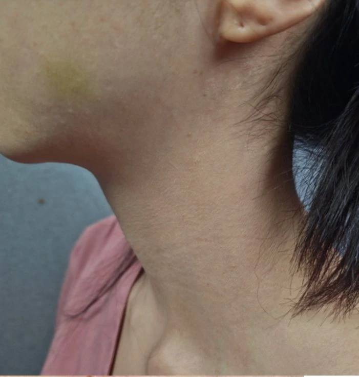 before_image