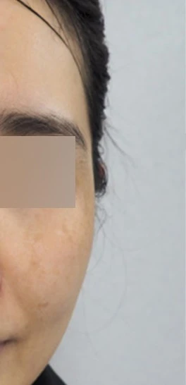 before_image