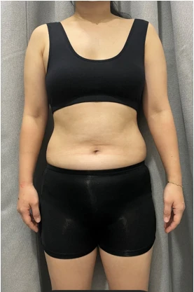 before_image