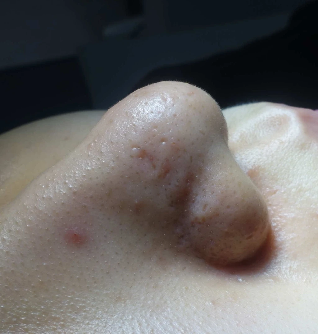 before_image