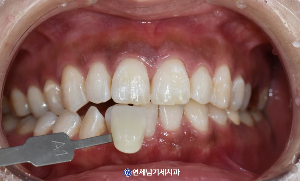 before_image