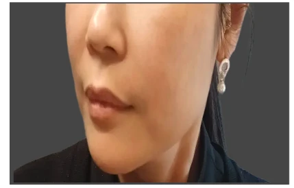 before_image