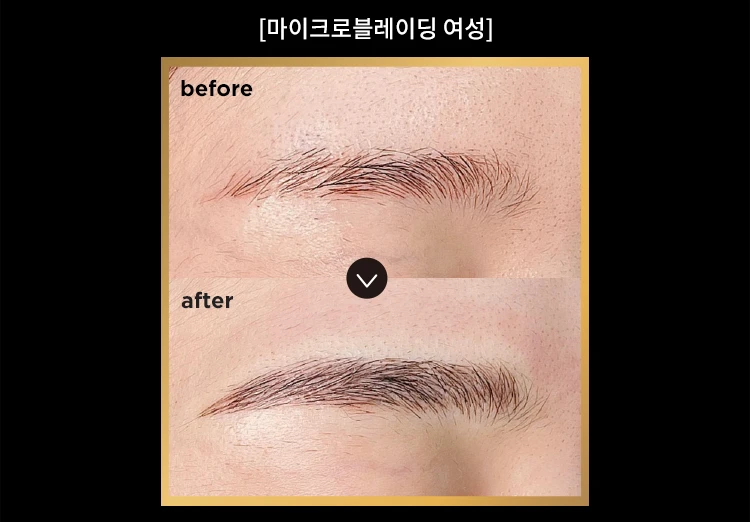 before_image