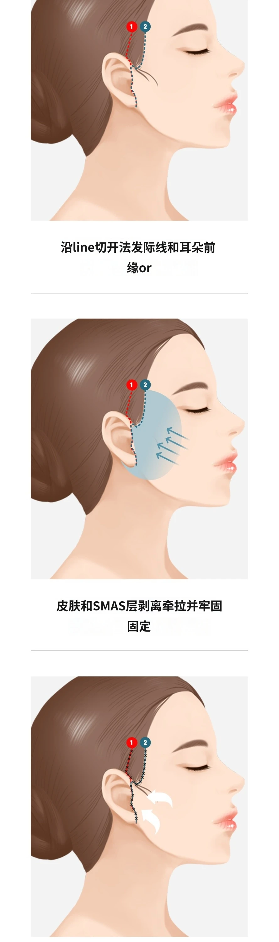 treatmentIntroduction