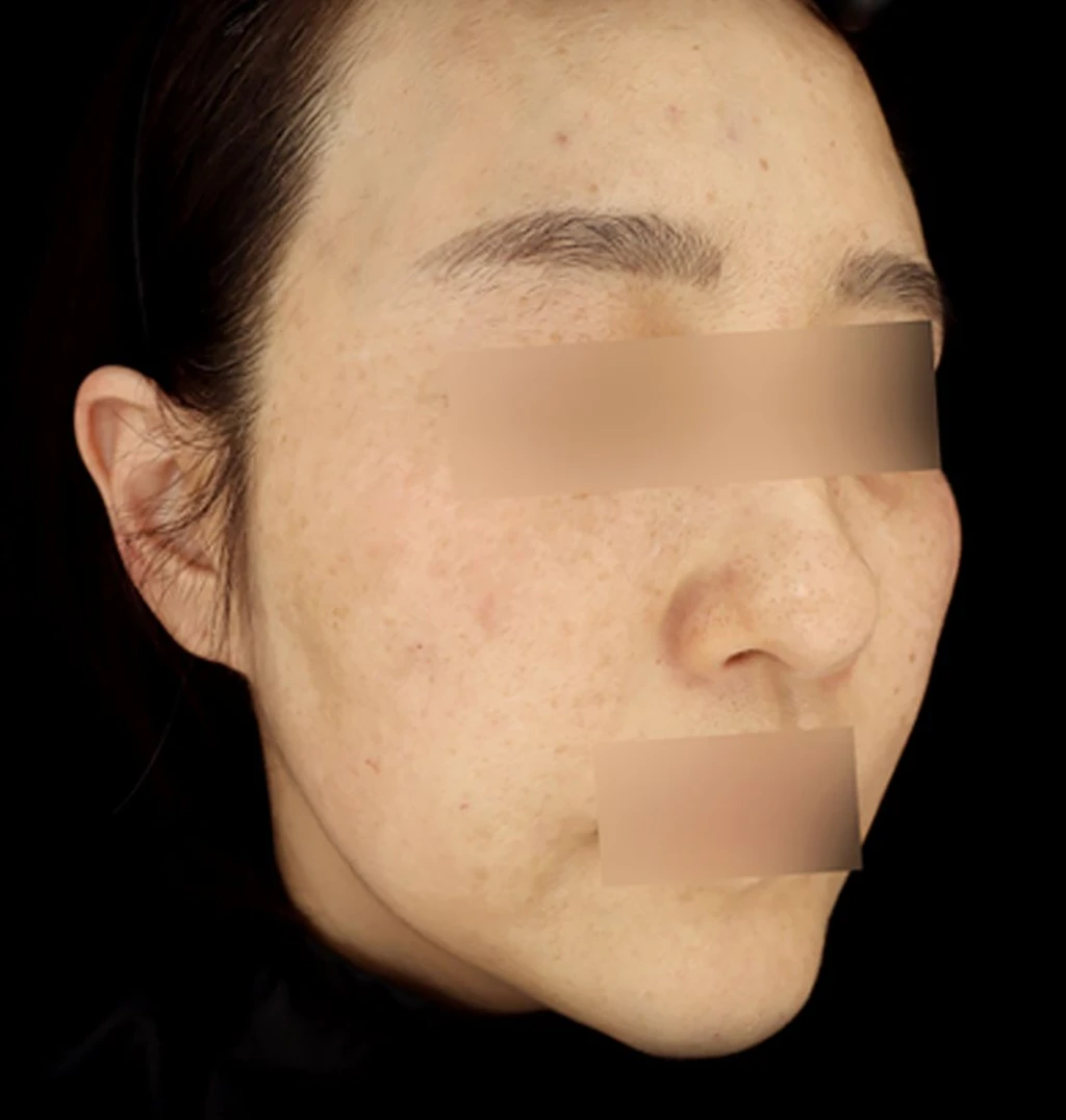 before_image