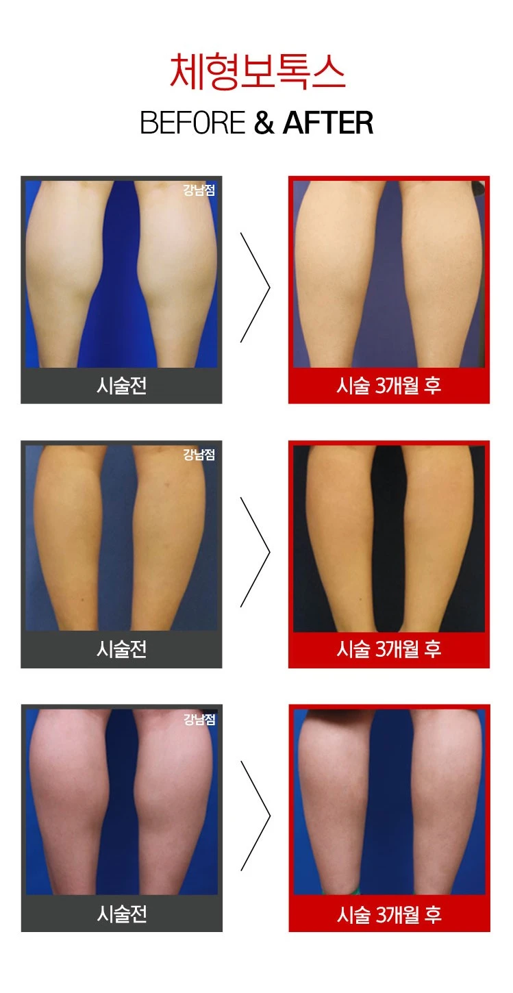 before_image