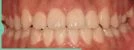 before_image