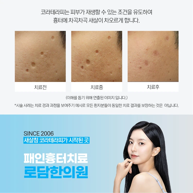 treatmentIntroduction