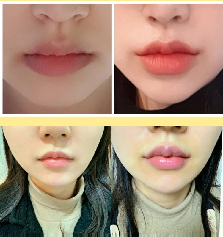 before_image