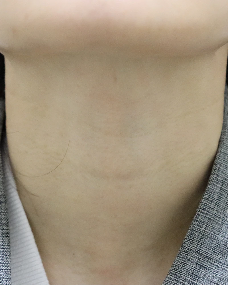 before_image