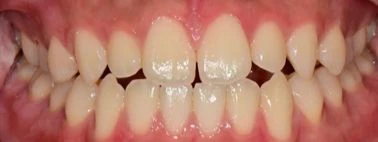 before_image