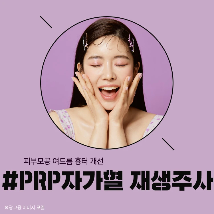 event thumbnail image