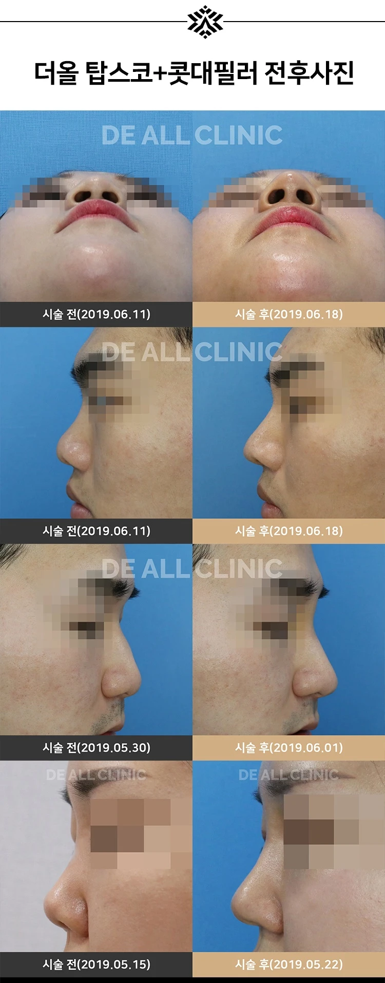 before_image