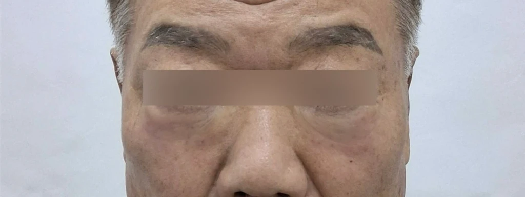 before_image
