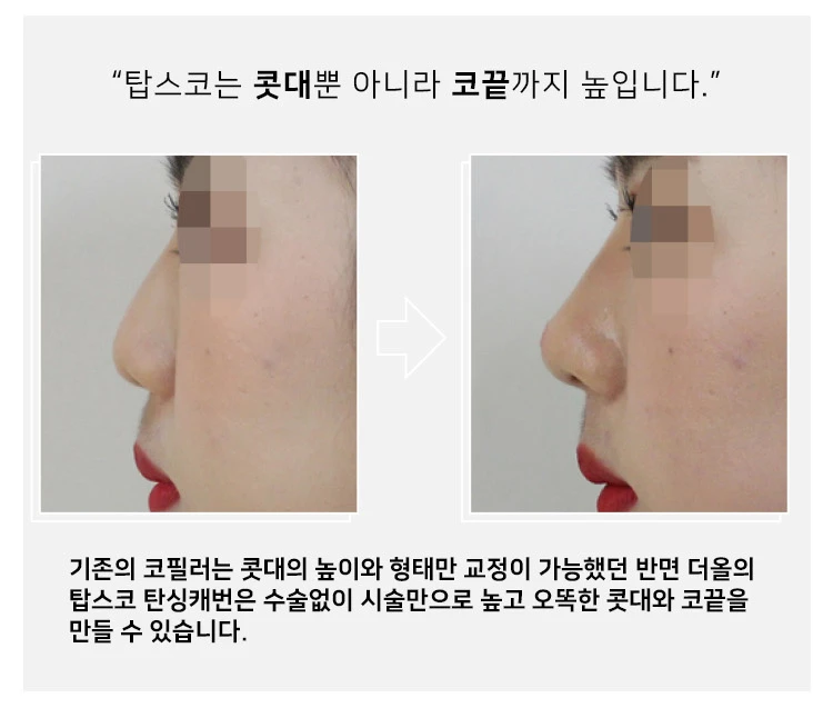 before_image