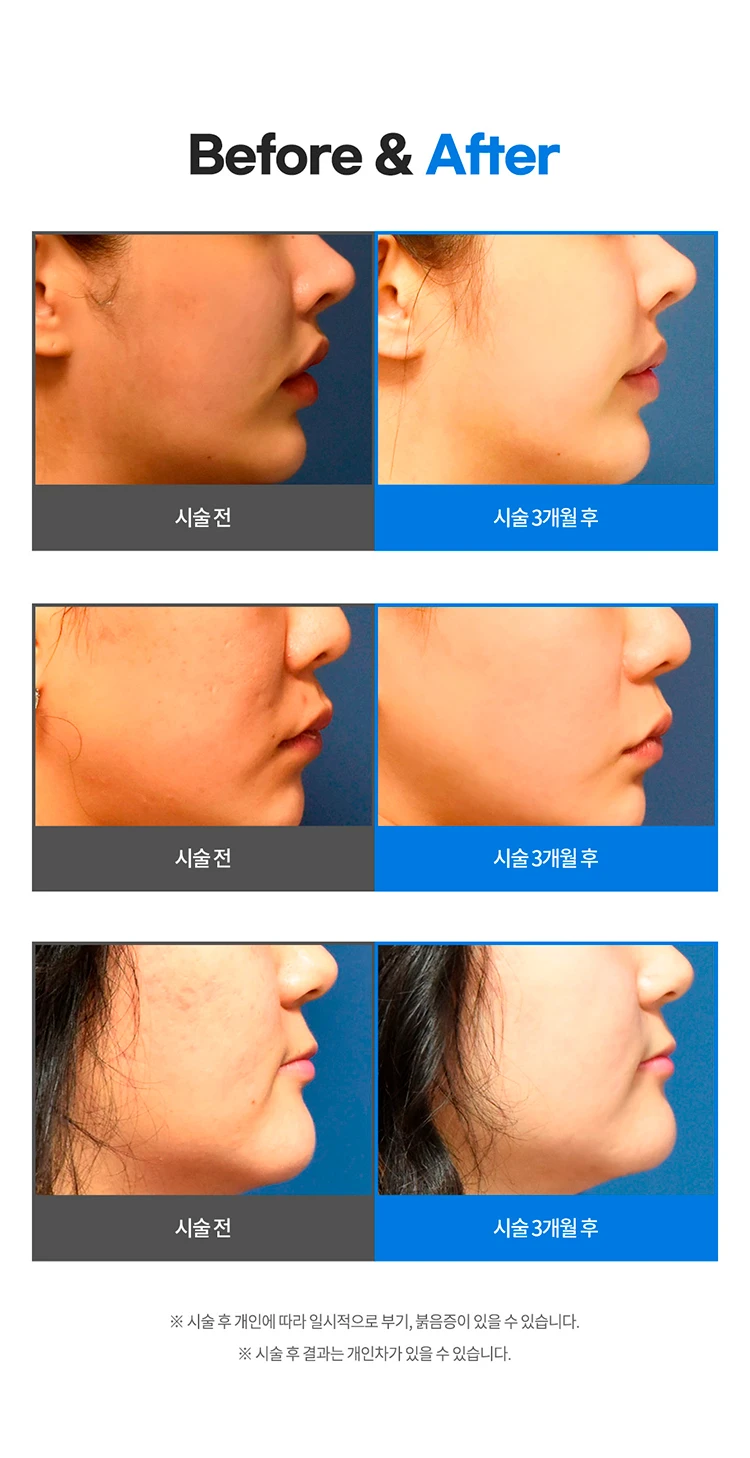before_image