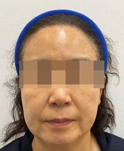 before_image