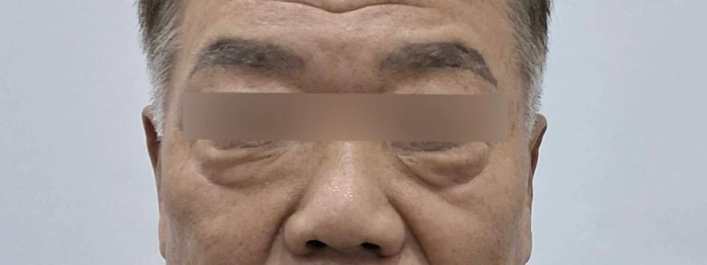 before_image