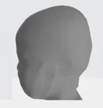 before_image