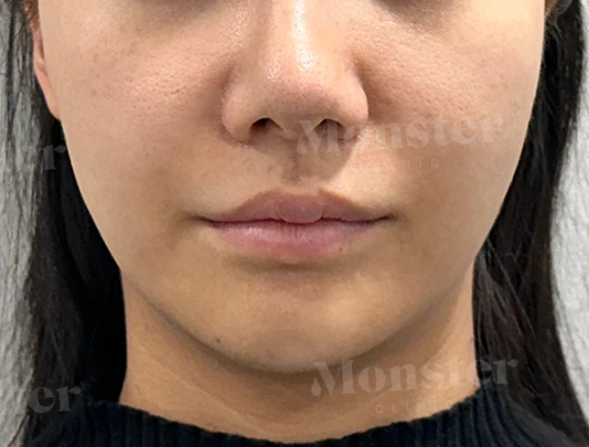 before_image