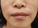 before_image