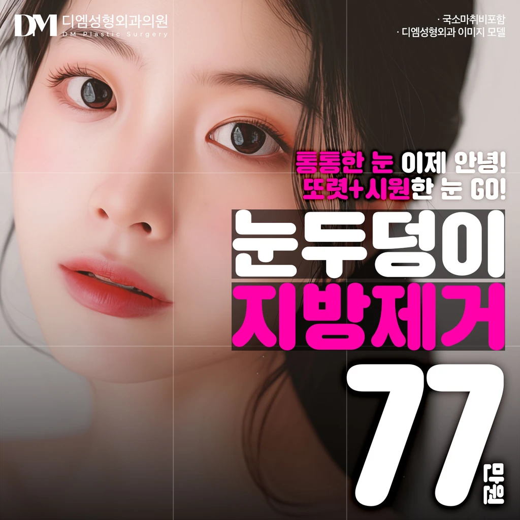 event thumbnail image