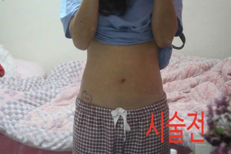 before_image