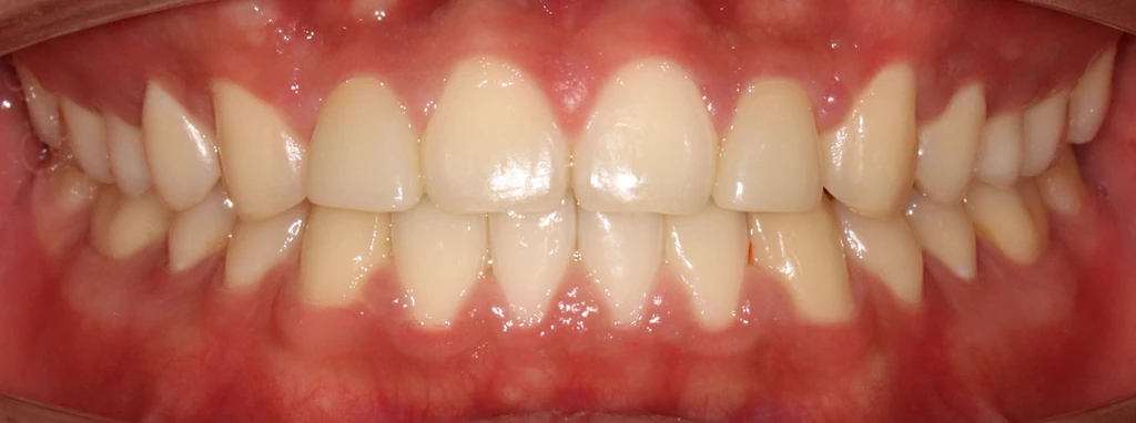 before_image