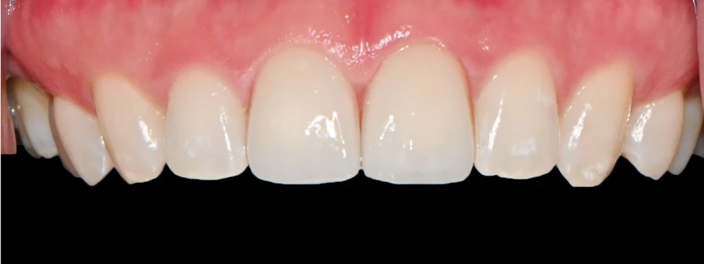 before_image